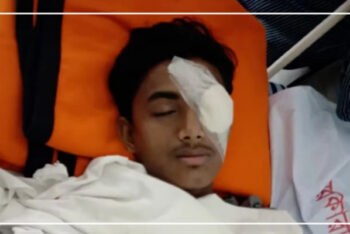 চোখ হারানো আলিফের বাবা অসুস্থ, মা প্রতিবন্ধী