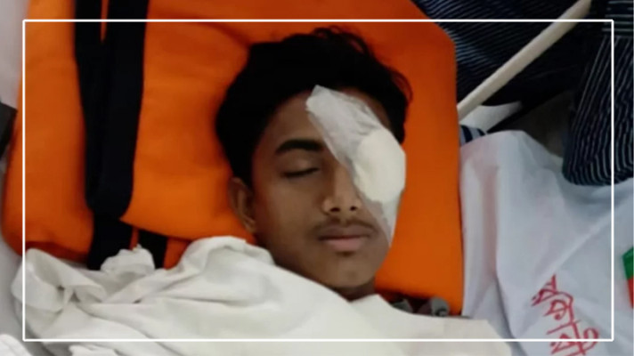 চোখ হারানো আলিফের বাবা অসুস্থ, মা প্রতিবন্ধী