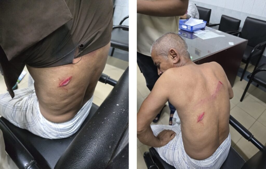সদর উপজেলায় অতর্কিত হামলায় বৃদ্ধ আহত: নগদ টাকা ও মোবাইল লুট