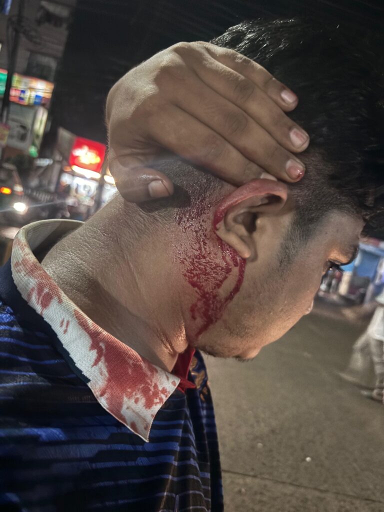 বিশ্বকাপের খেলা দেখা নিয়ে শাবিপ্রবিতে মারামারি, আহত ১