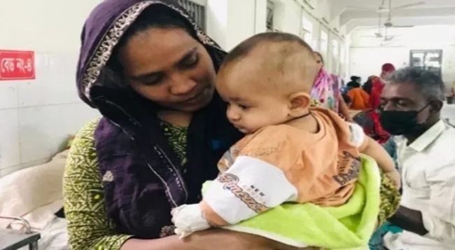 হামের উপসর্গে আরও ২ শিশুর মৃত্যু সিলেটে
