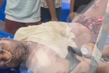 ছাতকে প্রতিপক্ষের হামলায় বালু ব্যবসায়ী আহত