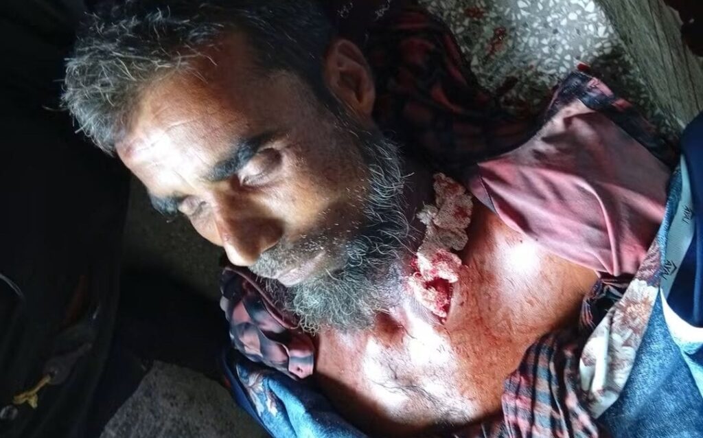 সিলেটে মেয়েকে ধর্ষণের অভিযোগে প্রাণ গেল পিতার