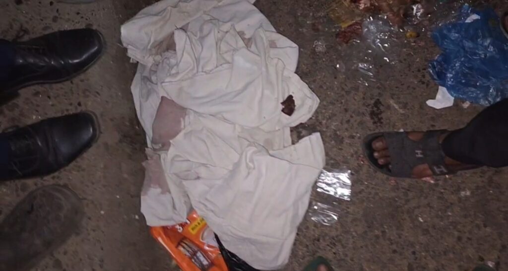আম্বরখানায় ময়লার স্তূপে পলিথিনে মোড়ানো কাটা পা