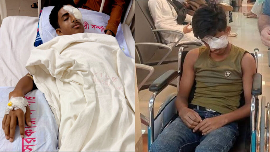 চোখ হারানো আলিফের সামনে এখন শুধুই অন্ধকার