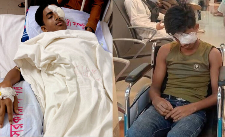 চোখ হারানো আলিফের সামনে এখন শুধুই অন্ধকার