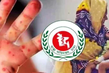 সিলেটে হামে আরো দুই শিশুর মৃত্যু, মৃতের সংখ্যা দাঁড়ালো ১৬৮ জনে